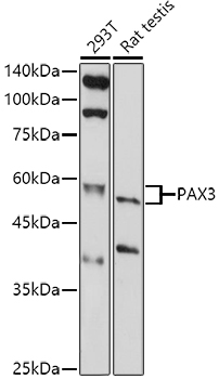 PAX3 Rabbit polyclonal antibody