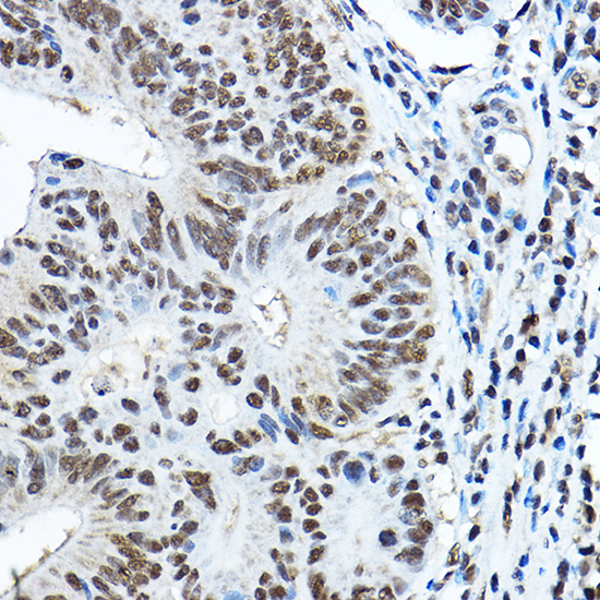PAX3 Rabbit polyclonal antibody