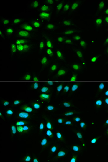 PAX3 Rabbit polyclonal antibody