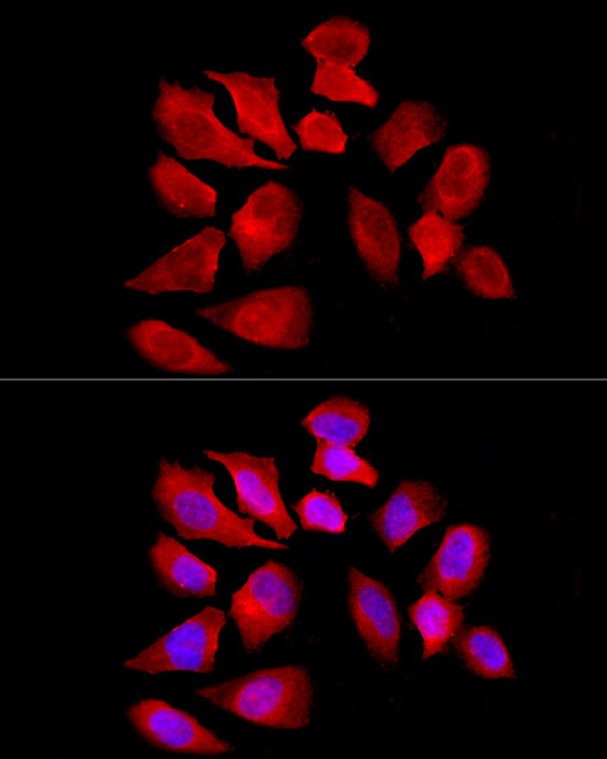 SLC22A5 Rabbit polyclonal antibody