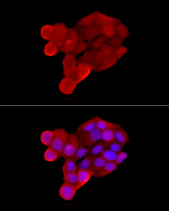 SLC22A5 Rabbit polyclonal antibody