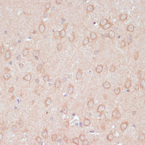 ARL4D Rabbit polyclonal antibody