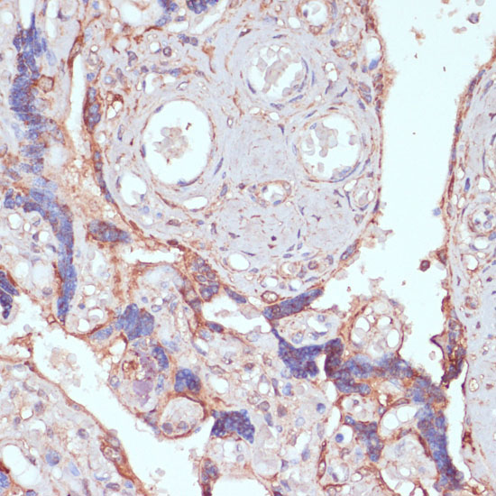ARL4D Rabbit polyclonal antibody