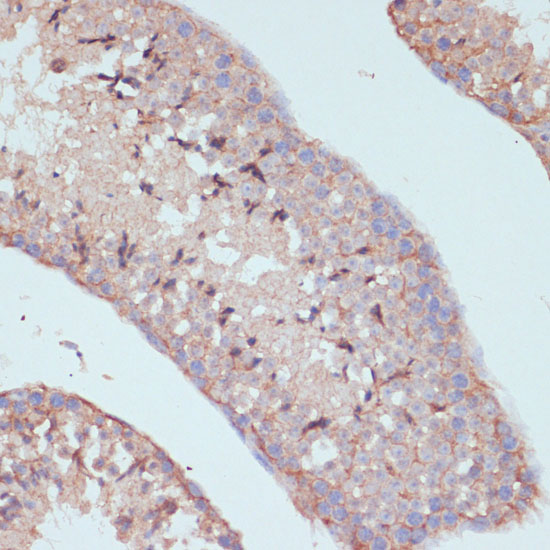 ARL4D Rabbit polyclonal antibody