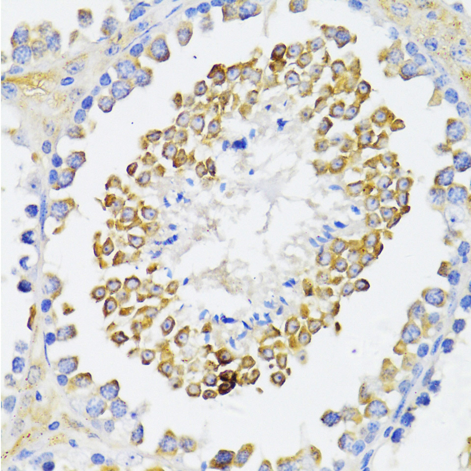 ARRB2 Rabbit polyclonal antibody