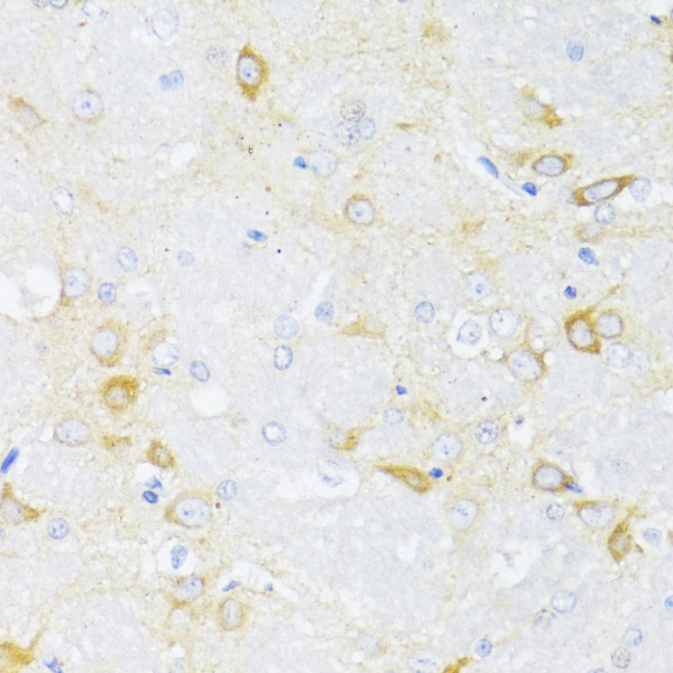 ARRB2 Rabbit polyclonal antibody