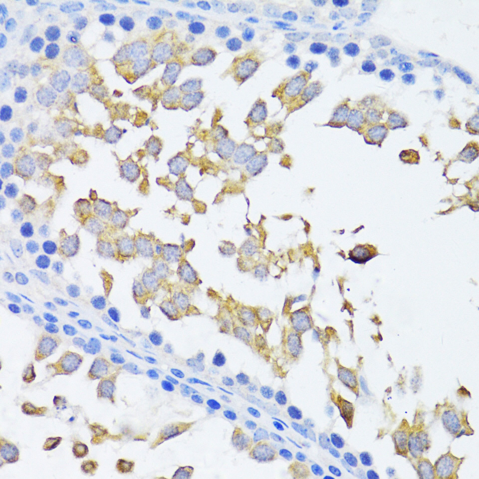 ARRB2 Rabbit polyclonal antibody