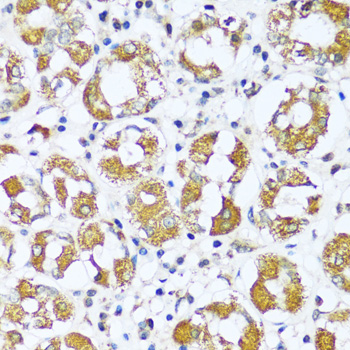 ATP5I Rabbit polyclonal antibody