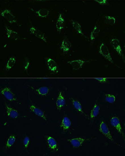 ATP5I Rabbit polyclonal antibody