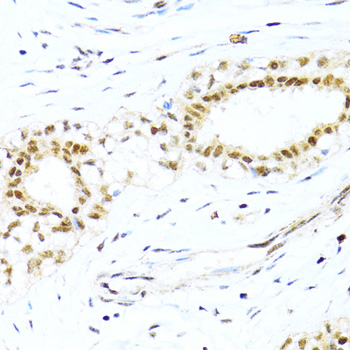 XRCC4 Rabbit polyclonal antibody