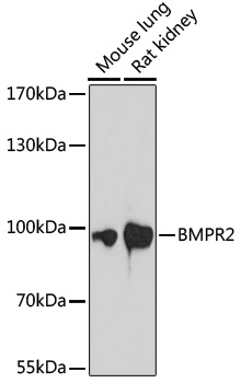BMPR2 Rabbit polyclonal antibody
