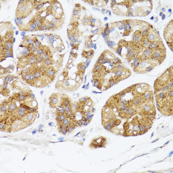 BMPR2 Rabbit polyclonal antibody