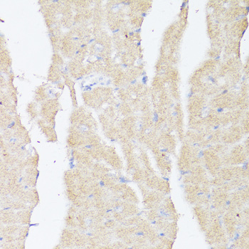BMPR2 Rabbit polyclonal antibody