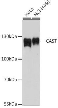 CAST Rabbit polyclonal antibody