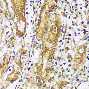 CAST Rabbit polyclonal antibody