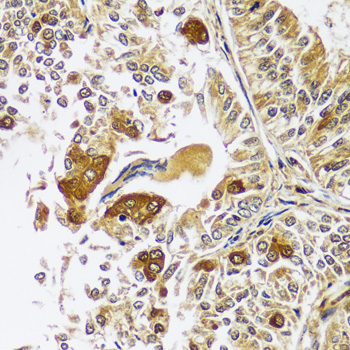 CAST Rabbit polyclonal antibody