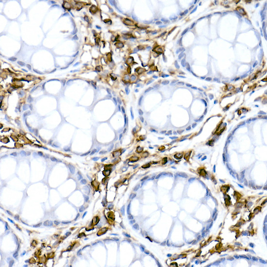 CD38 Rabbit polyclonal antibody