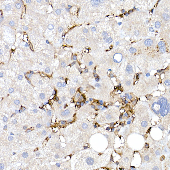 CD38 Rabbit polyclonal antibody
