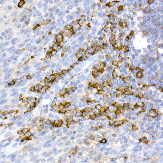 CD38 Rabbit polyclonal antibody