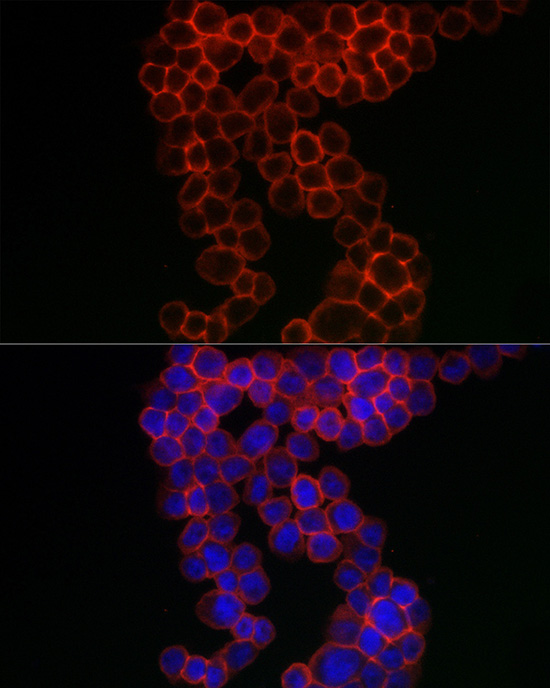 CD38 Rabbit polyclonal antibody