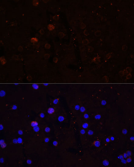 CD86 Rabbit polyclonal antibody