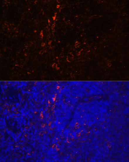 CD86 Rabbit polyclonal antibody