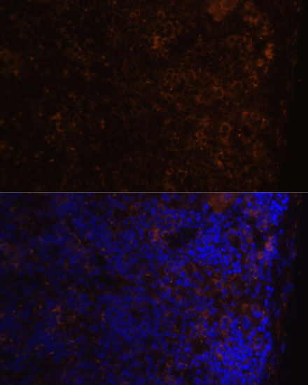 CD86 Rabbit polyclonal antibody