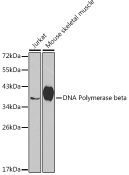 [KO Validated] DNA Polymerase beta Rabbit polyclonal antibody