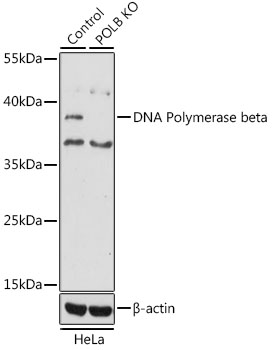 [KO Validated] DNA Polymerase beta Rabbit polyclonal antibody
