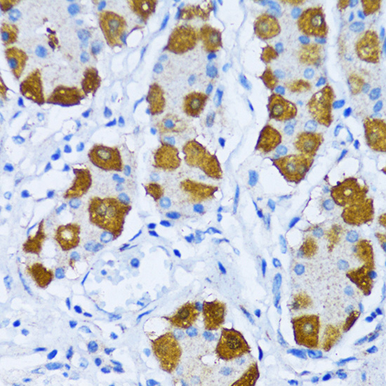 [KO Validated] DNA Polymerase beta Rabbit polyclonal antibody