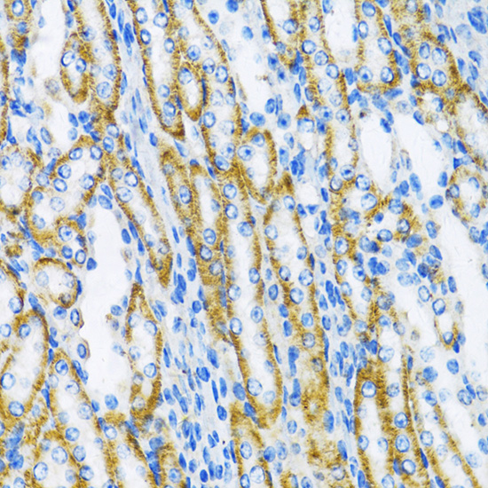 [KO Validated] DNA Polymerase beta Rabbit polyclonal antibody
