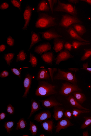 [KO Validated] DNA Polymerase beta Rabbit polyclonal antibody