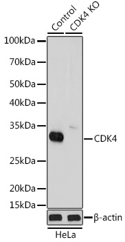 [KO Validated] CDK4 Rabbit polyclonal antibody