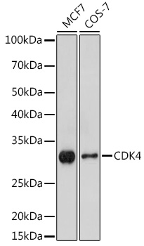 [KO Validated] CDK4 Rabbit polyclonal antibody