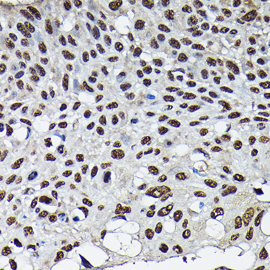 [KO Validated] CDK4 Rabbit polyclonal antibody