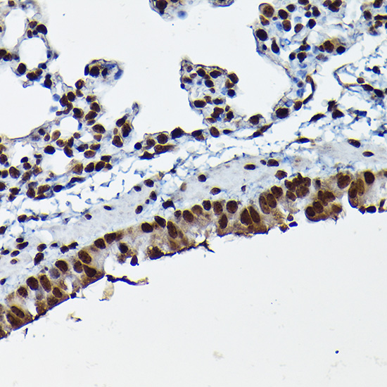 [KO Validated] CDK4 Rabbit polyclonal antibody