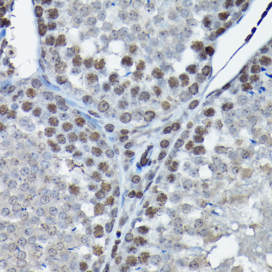 [KO Validated] CDK4 Rabbit polyclonal antibody