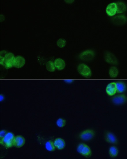 CHRM1 Rabbit polyclonal antibody