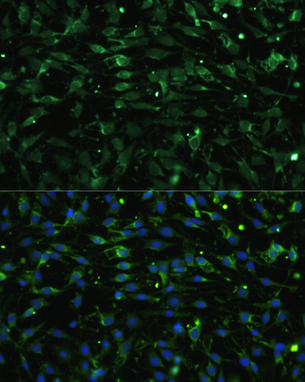 CHRM1 Rabbit polyclonal antibody