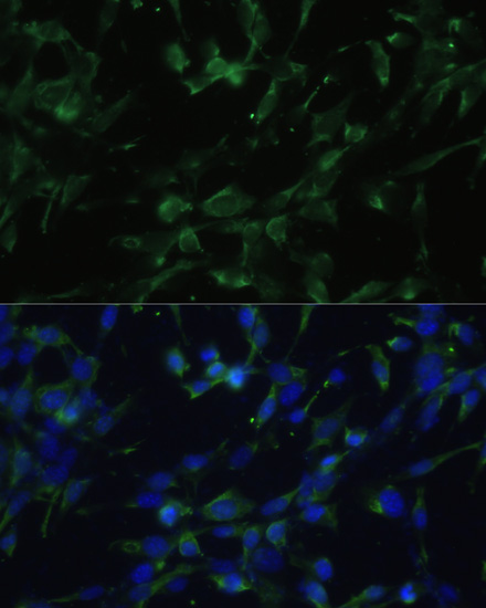 CHRM1 Rabbit polyclonal antibody