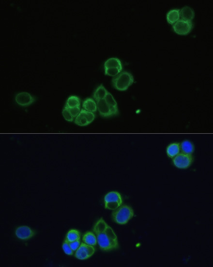 CHRM1 Rabbit polyclonal antibody