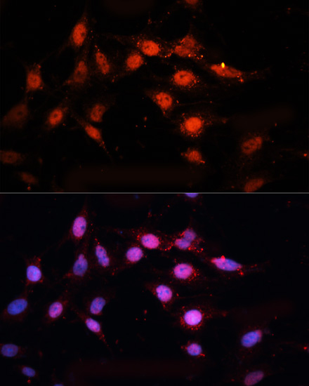 CTBP2 Rabbit polyclonal antibody