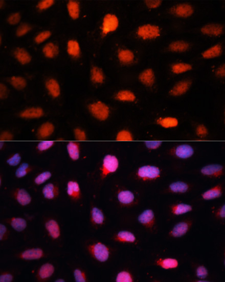 CTBP2 Rabbit polyclonal antibody
