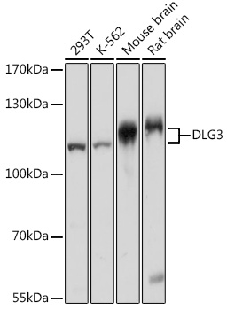 DLG3 Rabbit polyclonal antibody