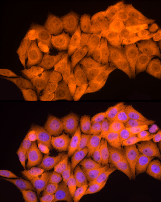 AKR1B1 Rabbit polyclonal antibody