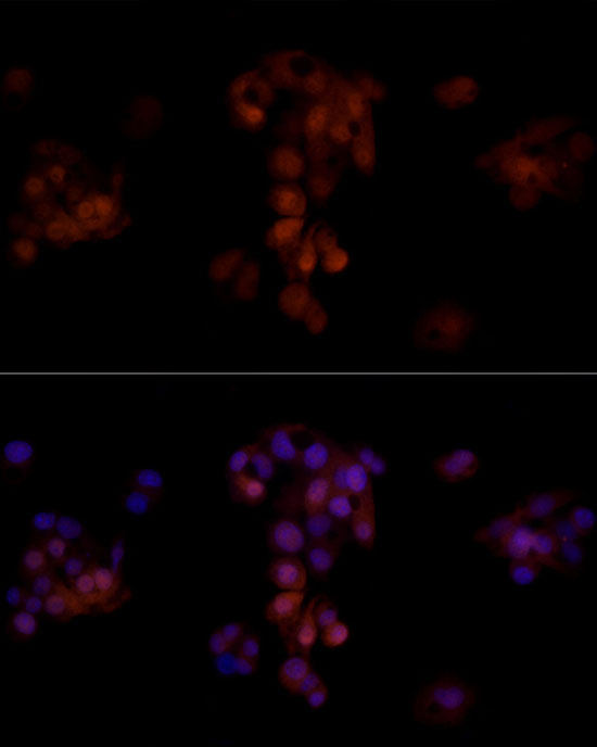 AKR1B1 Rabbit polyclonal antibody