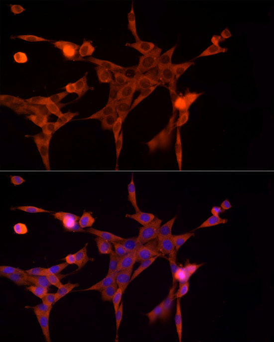 AKR1B1 Rabbit polyclonal antibody