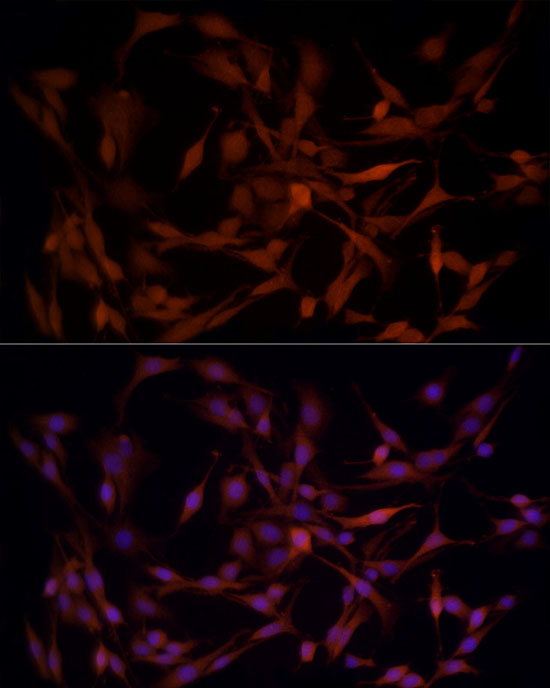 AKR1B1 Rabbit polyclonal antibody