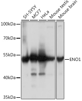 ENO1 Rabbit polyclonal antibody