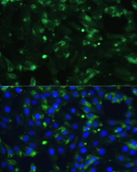 ENO1 Rabbit polyclonal antibody